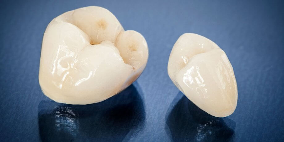 The Pros and Cons of Dental Crowns